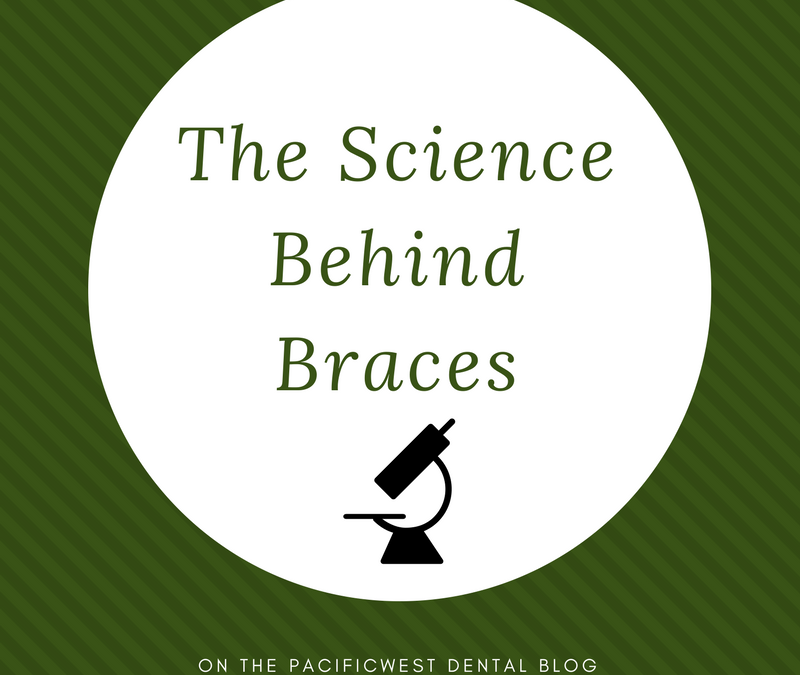 The Science Behind Braces