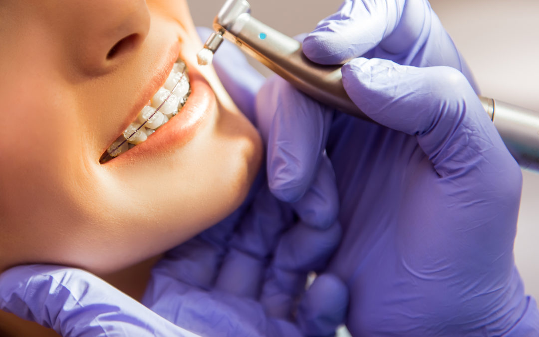 Is Accelerated Orthodontics for Me?