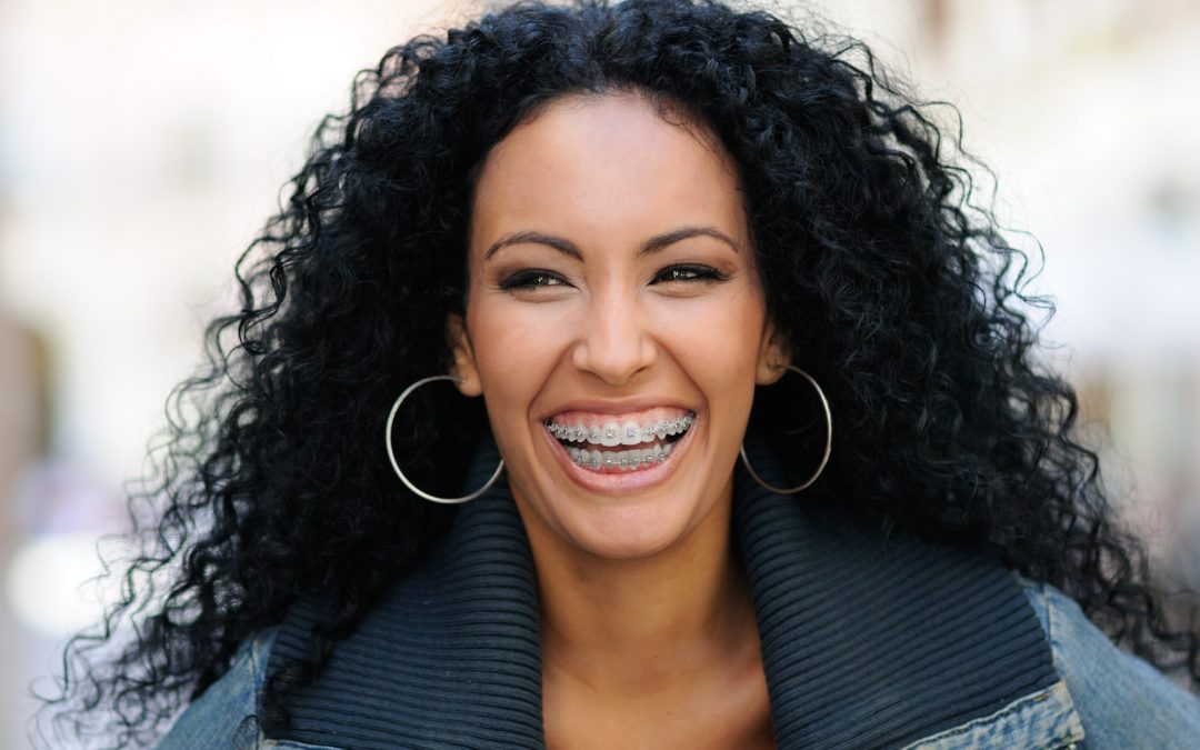 How to Care for Your Clear Braces