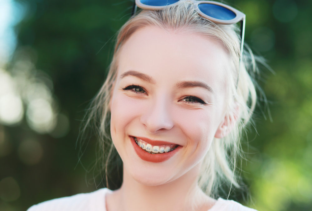 Can Braces be Stylish?