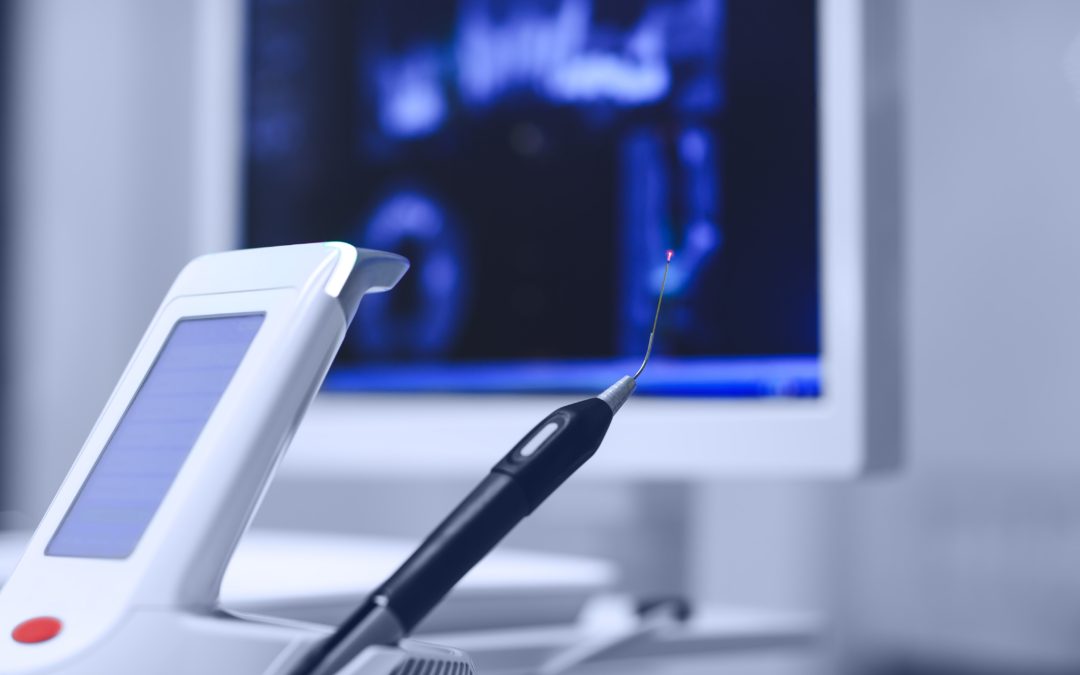 Common Applications of a Dental Laser in Orthodontic Treatment