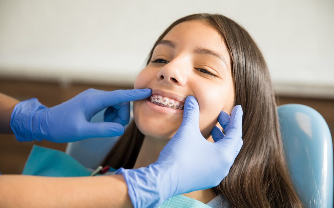 How Have Dental Braces Evolved?