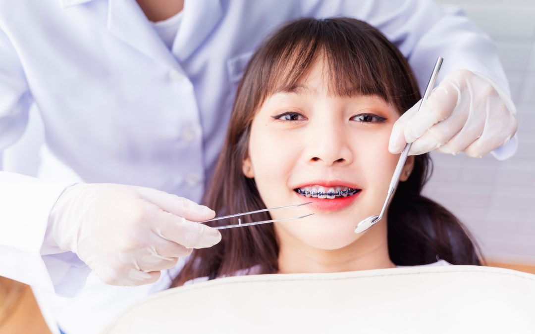 Tips to Prepare for Braces or Invisalign Treatment