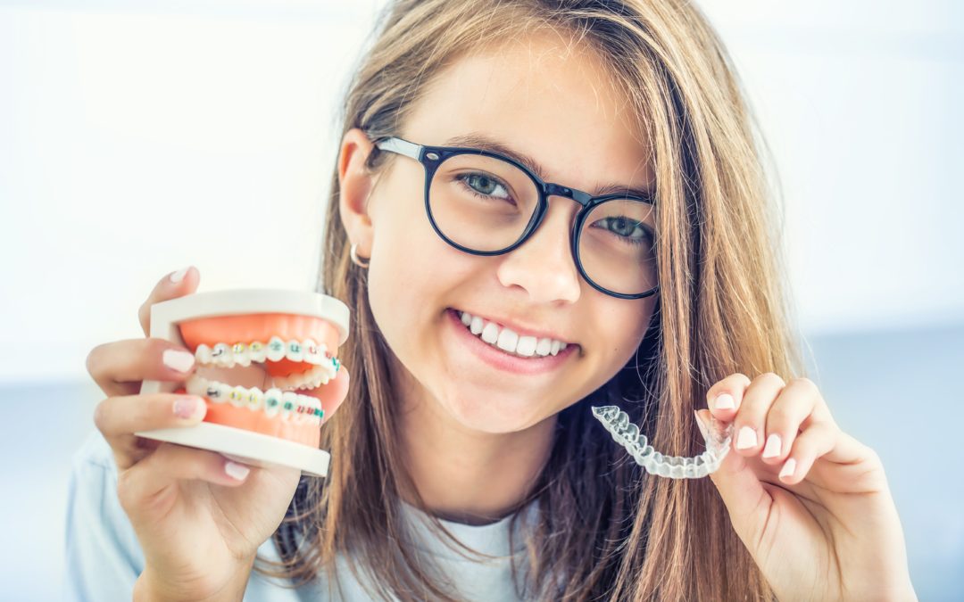 What Type Of Braces Work The Fastest