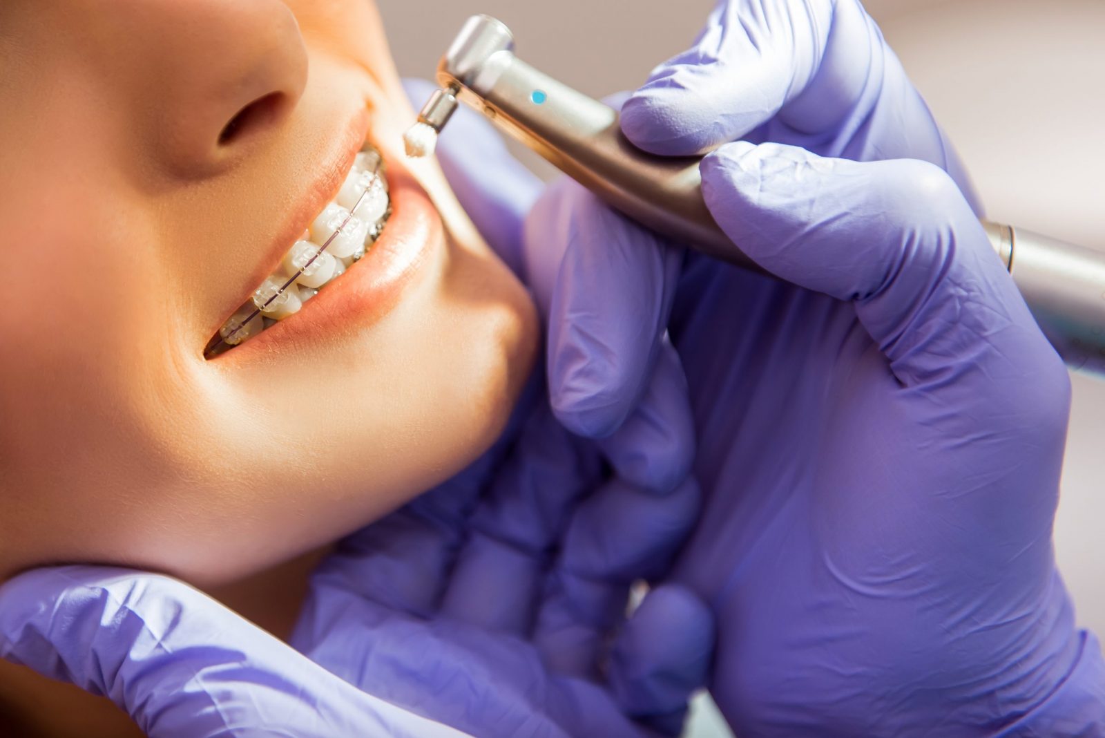 Accelerated Orthodontics | Treatments For Straight Teeth | Pacific West ...