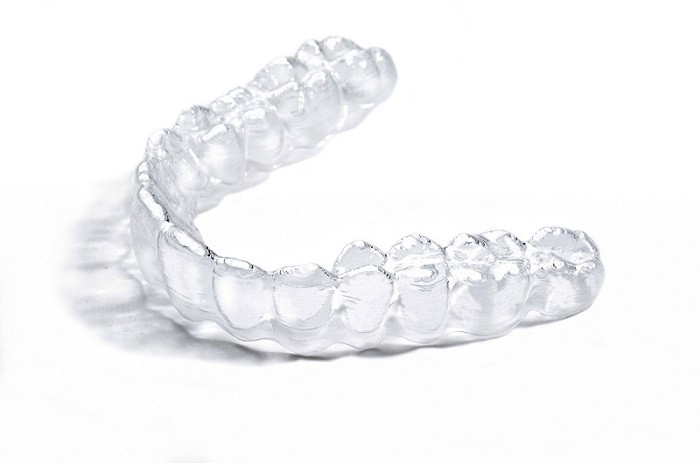 Invisalign: 5 Reasons to Choose Clear Aligners - Diamond Head